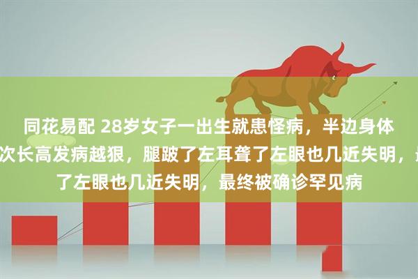 同花易配 28岁女子一出生就患怪病，半边身体长满“苔藓”，每次长高发病越狠，腿跛了左耳聋了左眼也几近失明，最终被确诊罕见病